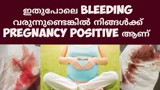 Early Pregnancy bleeding Deechus world Malayalam [upl. by Perni]