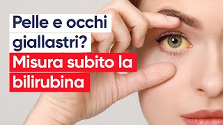 Bilirubina alta quando preoccuparsi e quali sono le cause [upl. by Bink]