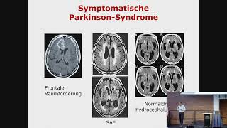 Vortrag „Bildgebende Verfahren bei Parkinson“ [upl. by Araz]