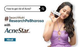 Acne problem SearchNahiResearchPeBharosa with AcneStar Gel  RaashiiKhannaOfficial  Hindi [upl. by Larret]