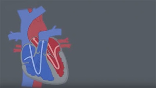 Congenital Heart Defects CHDs [upl. by Tanya15]