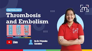 Thrombosis and Embolism with Dr Priyanka Sachdev [upl. by Euqinom]