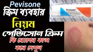 Pevisone Cream ointment Review [upl. by Breed]