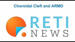 Choroidal Cleft and nARMD activity [upl. by Niccolo]