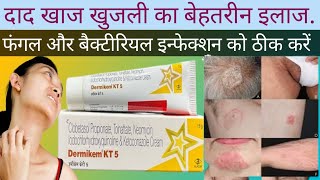 Dermikem kt 5 Cream ke Fayde Dermikem kt 5 Cream Uses in Hindi [upl. by Aemat49]