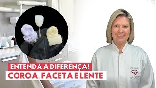 Entenda a Diferença Coroa Lente de contato e Faceta [upl. by Allimrac]