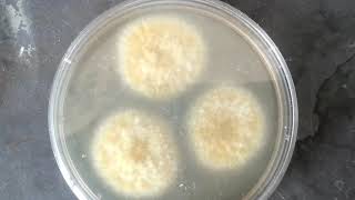 Aspergillus flavus isolation from the clinical specimen KOH mount Colony morphology LPCB mount [upl. by Deadman]