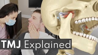 TMJ Explained  Jaw Pain Causes amp Symptoms [upl. by Labanna]