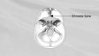 SPHENOID BONE 1 [upl. by Kornher]