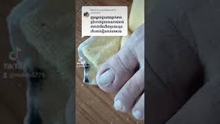 Clean clients dirty toenail and return with healthy feet nail​​​ asmr fyp ear shorts viral [upl. by Petromilli]