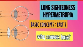 HYPERMETROPIA  BASICS to ADVANCED [upl. by Deina204]