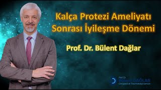 Kalça Protezi Ameliyatı Sonrası İyileşme Dönemi [upl. by Sirromad833]