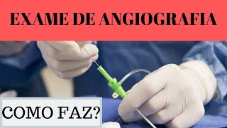 exame de angiografia como faz [upl. by January]