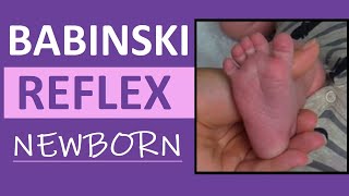 Babinski Reflex Assessment in Newborn Infant  Pediatric Nursing Clinical Skills [upl. by Atinaw]