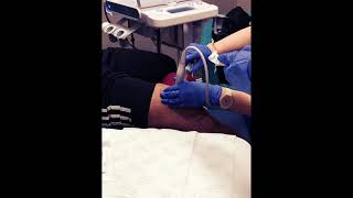 Knee Aspiration Knee Draining Procedure 2018 [upl. by Oglesby381]