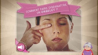 Comment faire disparaître un orgelet [upl. by Nirel]