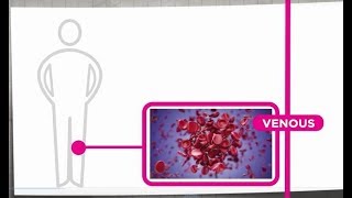 Venous Thrombosis Explained [upl. by Eimmij]