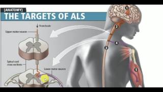 MEDICINE LECTURES  Neurology  AMYOTROPHIC LATERAL SCLEROSIS [upl. by Thistle]