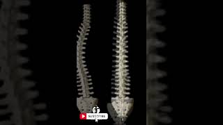 Understanding Scoliosis  A Curvature Worthy of Attention [upl. by Spevek]