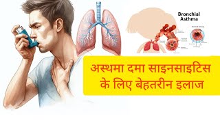 अस्थमा साइनसाइटिस के लिए बेहतरीन इलाज  Asthama sinus treatment [upl. by Vaientina275]