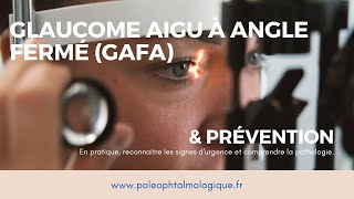 Glaucome aigu à angle fermé et sa prévention par iridotomie laser Pole ophtalmologique [upl. by Neufer]