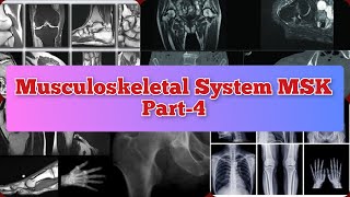 Radiology Viva Cases  399403  Musculoskeletal System Part4  MSK medical radiology ultrasound [upl. by Tingey96]