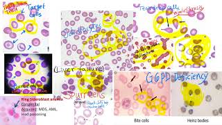 hematology in 10 min Peripheral blood smear examination under microscope [upl. by Ayram853]