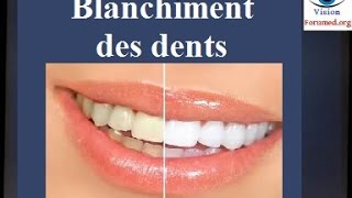 Blanchiment des dents techniques [upl. by Amando425]