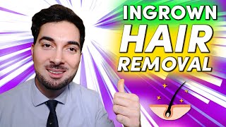 How To Get Rid Of Ingrown Hair Removal and Treatment [upl. by Leemaj]