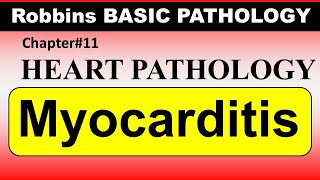 Chp11 Robbins Patho  Heart Pathology  Myocarditis  Dr Asif Lectures [upl. by Gwenni868]