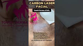 hyper pigmentation Acneblack dotsCarbon peeling at TOUCH Derma clinicus80778432577840050530 [upl. by Elleivad]