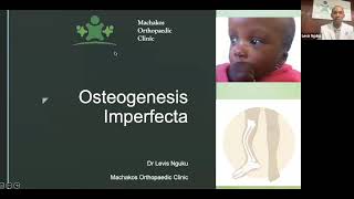 Discussion on Osteogenesis Imperfecta by Dr Levis Nguku [upl. by Cordi]