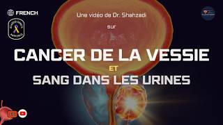 Cancer de la Vessie  Signes Précoces Symptômes et Sang dans les Urines Expliqués [upl. by Fredkin]