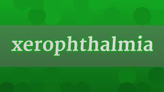 XEROPHTHALMIA pronunciation • How to pronounce XEROPHTHALMIA [upl. by Ecyak]