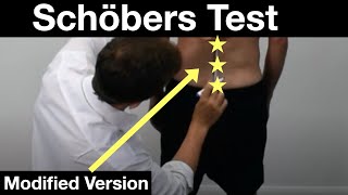 Modified Schöber Index Schöbers test for Lumbar Flexion  Ankylosing Spondylitis [upl. by Galateah]