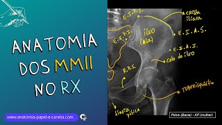 Anatomia Radiológica dos MMII  Como reconhecer Fraturas ou Luxações no RX [upl. by Adeirf]