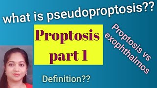 Proptosis Exophthalmos Pseudoproptosis Causes for psuedoproptosis MBBS Ophthalmology [upl. by Cadmar]