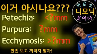 니모닉 Petechia purpura Ecchymosis [upl. by Ybbed]