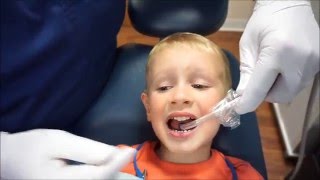 Fluoride Varnish Application [upl. by Tymothy]