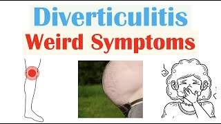 Weird Symptoms of Diverticulitis  Atypical Clinical Features of Diverticulitis [upl. by Rohn]