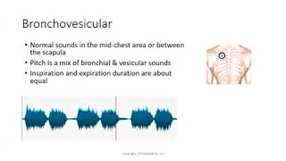 Bronchovesicular [upl. by Phillie645]