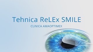 Tehnica ReLEx SMILE  AmaOptimex [upl. by Neiman]