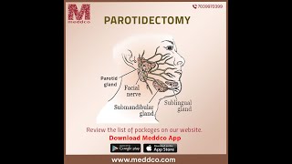 Parodectomy  Symptoms  Causes  Treatment [upl. by Oleta540]