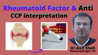 Rheumatoid Factor amp Anti  CCP interpretation  English Version [upl. by Dewhurst426]