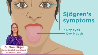 Sjogrens Syndrome  Dr Shruti Bajad  skincare arthritis [upl. by Donalt888]