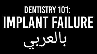 Dental Implant Failure بالعربي [upl. by Ruben]