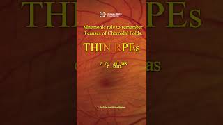 Choroidal Folds THIN RPEs Mnemonic rule to remember 8 causes [upl. by Valenba]