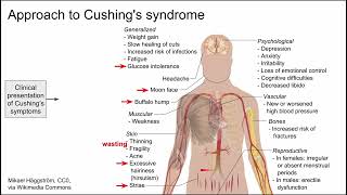 Approach to Cushings syndrome [upl. by Hwang]