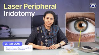 Laser Peripheral Iridotomy  Common Eye Conditions  The Eye Foundation eyecare eyecareservices [upl. by Oakleil]