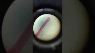 Ancylostoma whole mount zoology practical lab 🧪shorts [upl. by Granville638]